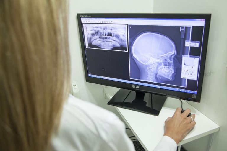 Chcesz znać dokładną diagnozę gdy idzie o badania radiologiczne?